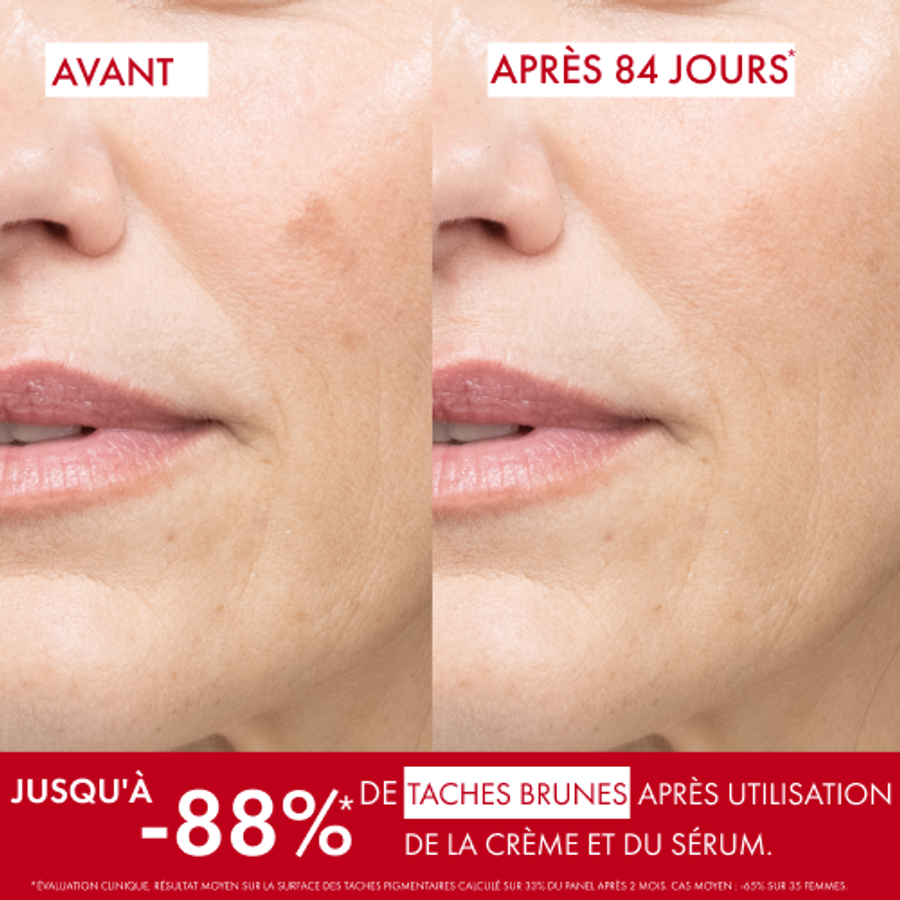 img4 (1) LIFTACTIV SÉRUM B3 ANTI-TACHES BRUNES ET ANTI-RIDES – Image 3
